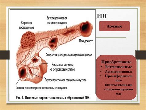 Диагностика не локализованности поджелудочной железы: основные методы