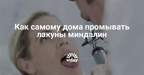 Как возникают случайные лакуны?