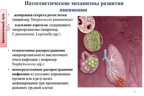 Компликации обратного развития пневмонии