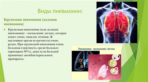 Основные причины обратного развития пневмонии