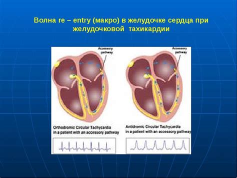 Симптомы аритмогенного действия