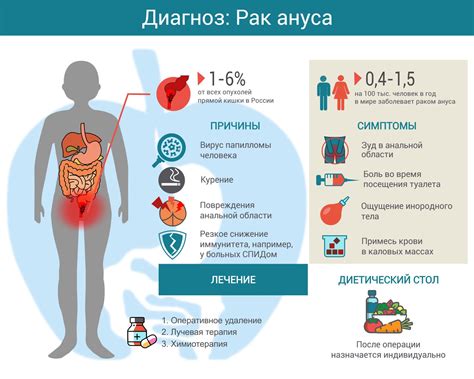 Эффективные методы лечения лимфоплазмоцитарной инфильтрации